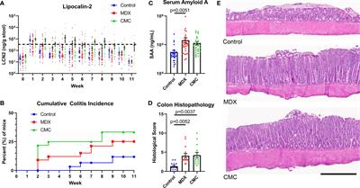 Maltodextrin Consumption Impairs the Intestinal Mucus Barrier and Accelerates Colitis Through Direct Actions on the Epithelium